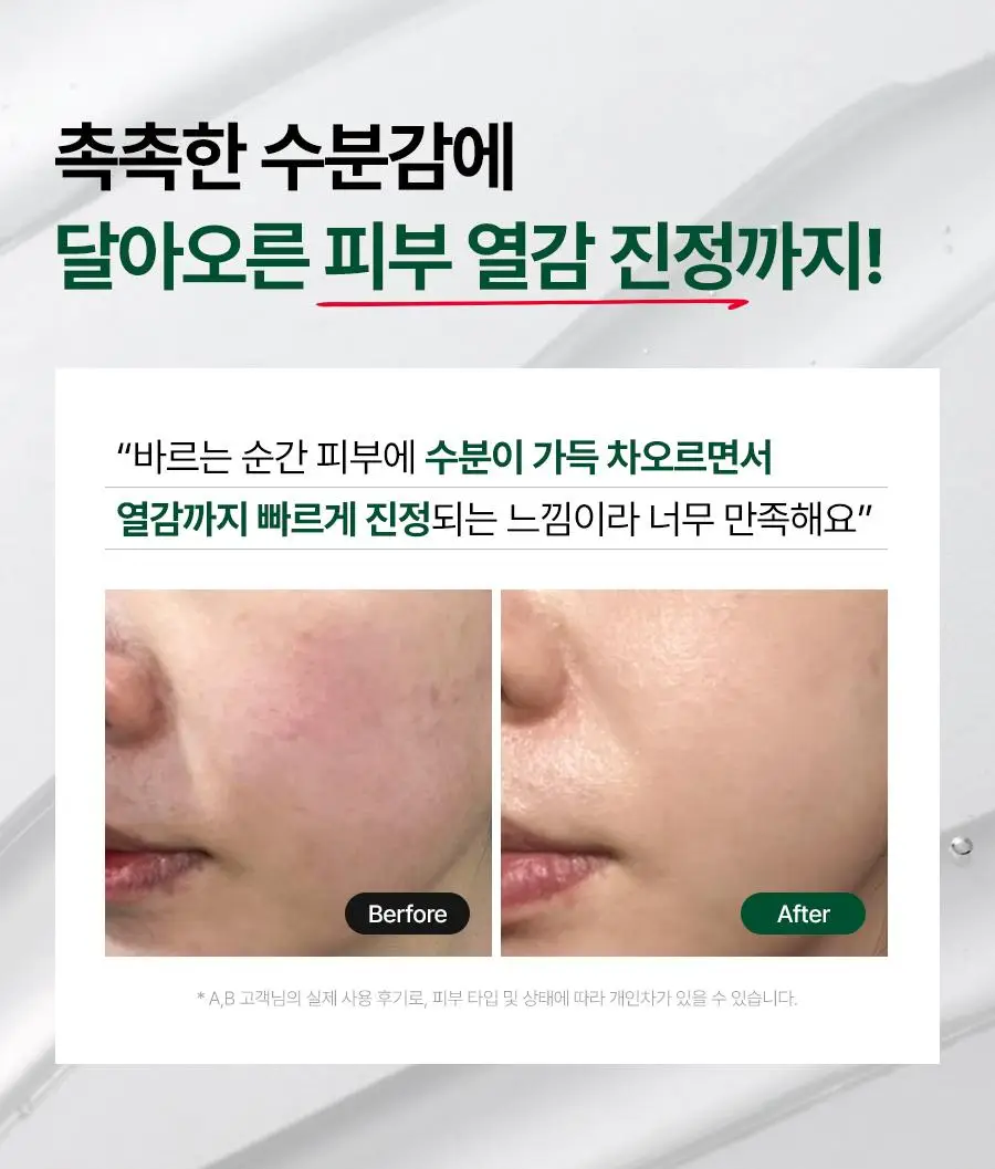 [쿨링수분진정] 닥터지 레드 블레미쉬 클리어 히알 시카 수딩 세럼 50ml 2종(20ml 증정기획, 단품] 상세페이지 7